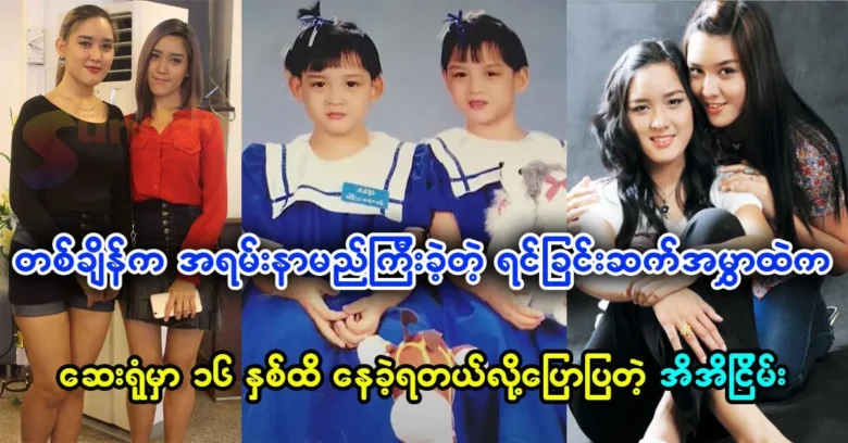 The once very famous conjoined twins Ei Ei Nyein